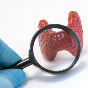 Changes+in+thyroid+nodule+blog